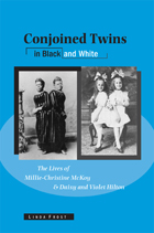 front cover of Conjoined Twins in Black and White