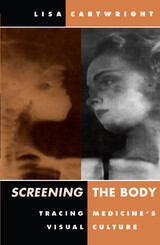 front cover of Screening The Body